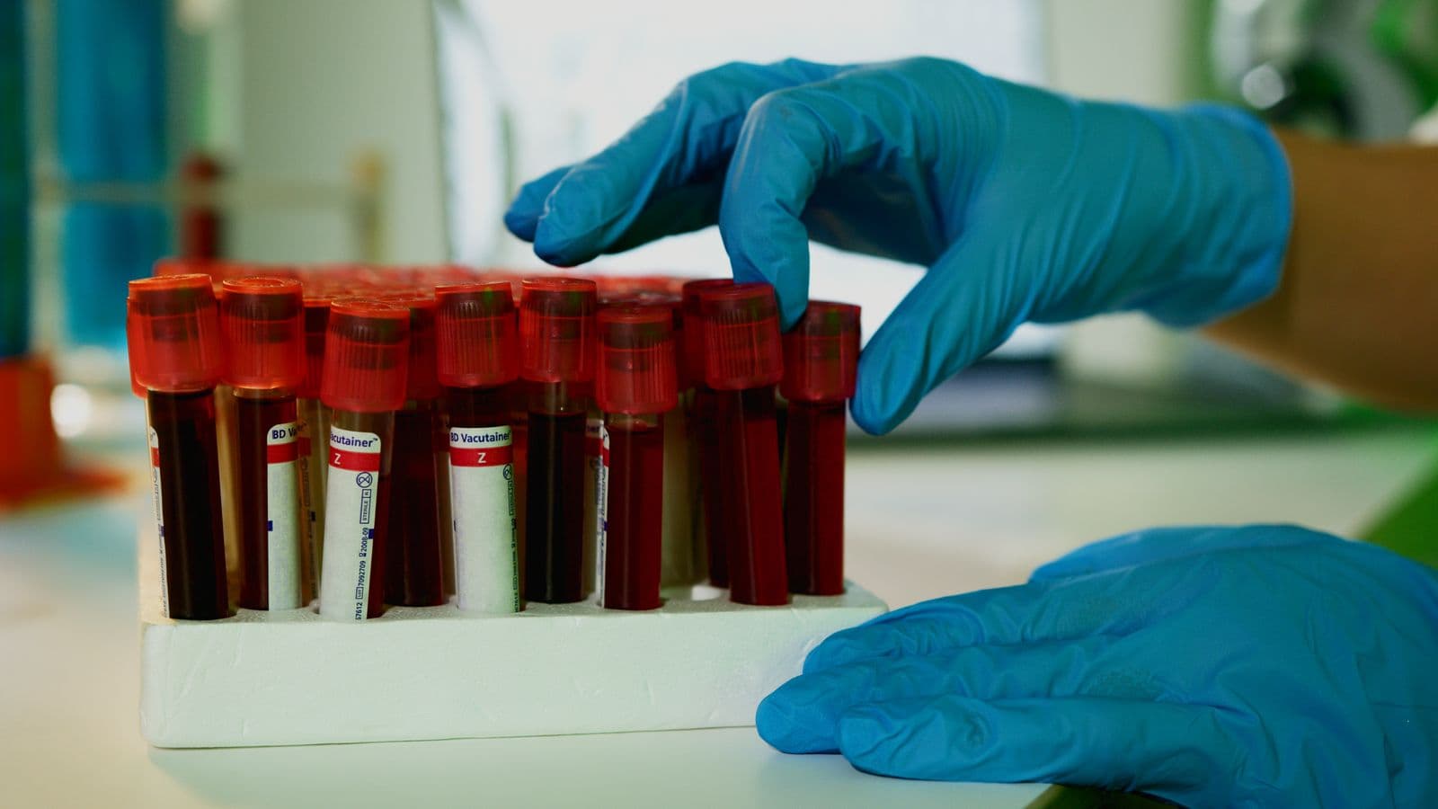 Blood sample vials in a laboratory rack — the metabolic and hormone markers we test for
